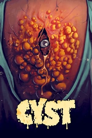 Nonton Film Cyst (2020) Terbaru